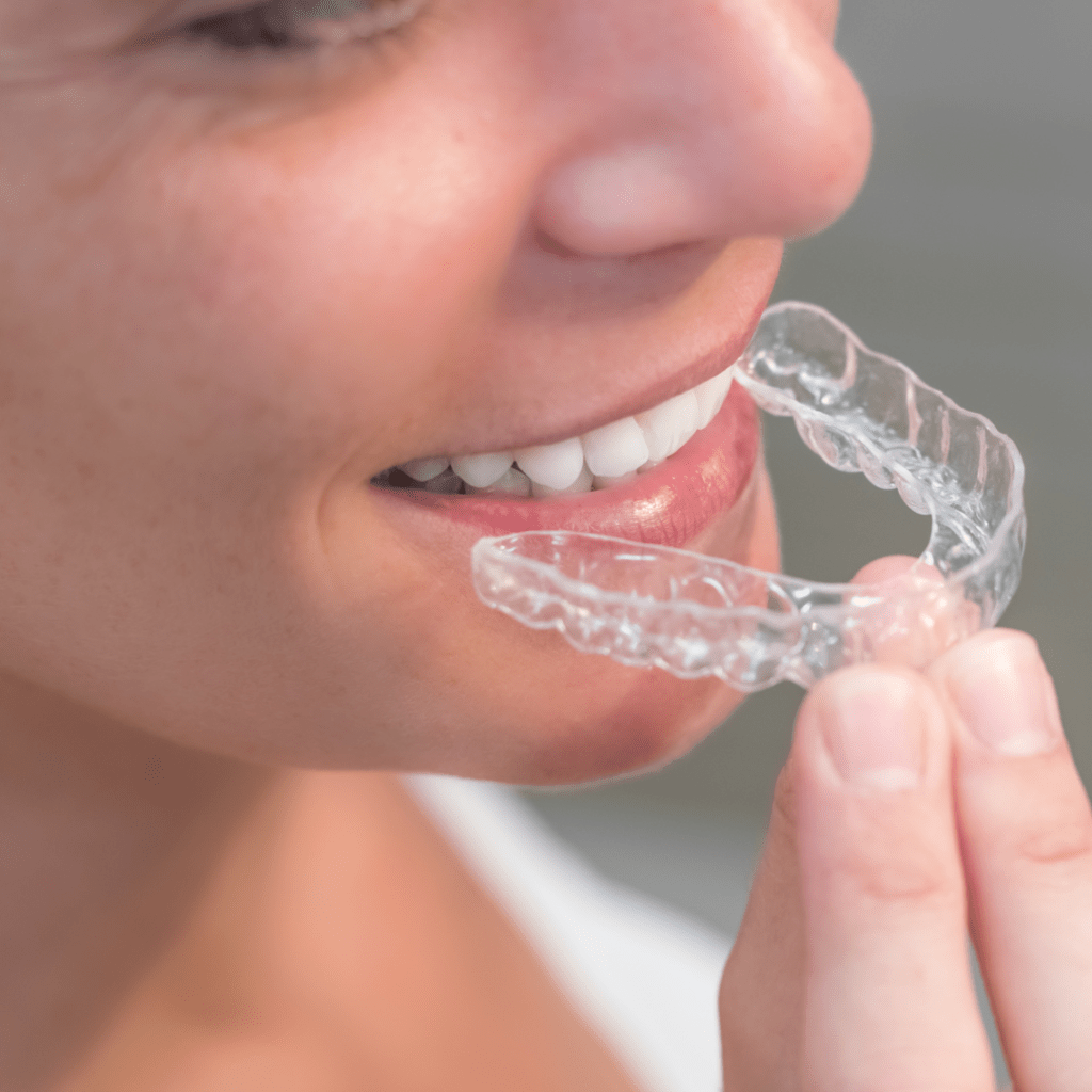 orthodontics holidays braces aligners summer